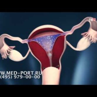 Основные причины бесплодия у женщин – гинекологические заболевания и патологии, приводящие к бесплодию