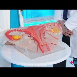 Хронический аднексит может быть причиной бесплодия