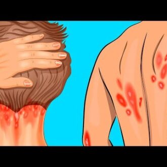 Может ли псориаз быть причиной бесплодия: диагностика и лечение, народные средства, расшифровка, таблица