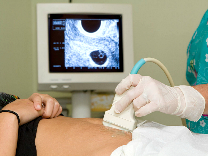 На каком сроке УЗИ показывает беременность и безопасно ли исследование на ранних сроках?