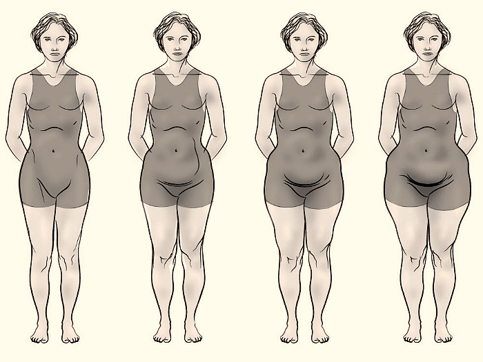 Симптомы избытка или нехватки женских гормонов эстрогенов
