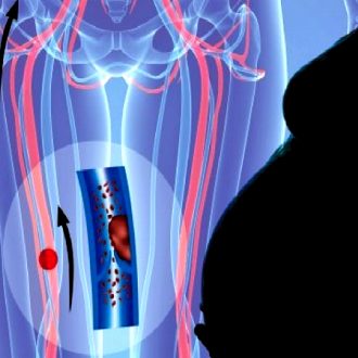 Д-димер при беременности: сроки выполнения анализа и расшифровка