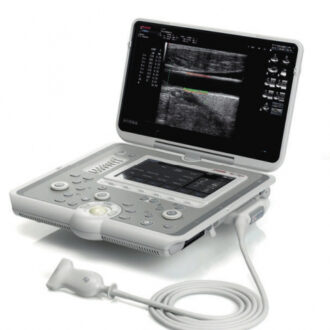 УЗИ аппарат: принцип работы, виды и применение в медицине