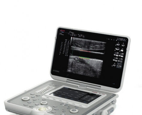 УЗИ аппарат: принцип работы, виды и применение в медицине