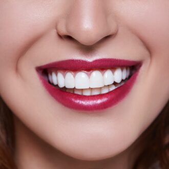 Виниры, их виды и эффект после применения