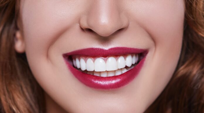 Виниры, их виды и эффект после применения