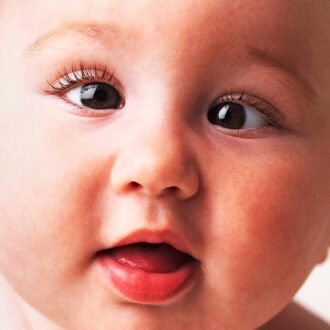 Косоглазие у детей: причины возникновения, виды, профилактика