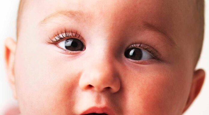 Косоглазие у детей: причины возникновения, виды, профилактика