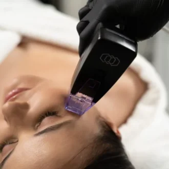 Фракционное радиочастотное фотоомоложение: всё, что нужно знать