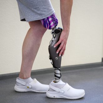 Протезирование ног: как устанавливать новые ноги и привыкать к ним