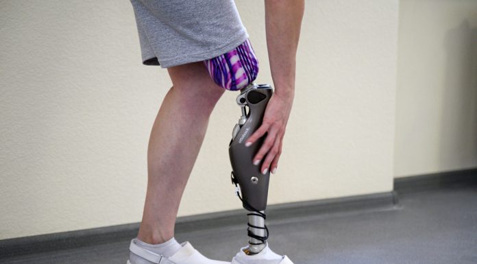 Протезирование ног: как устанавливать новые ноги и привыкать к ним