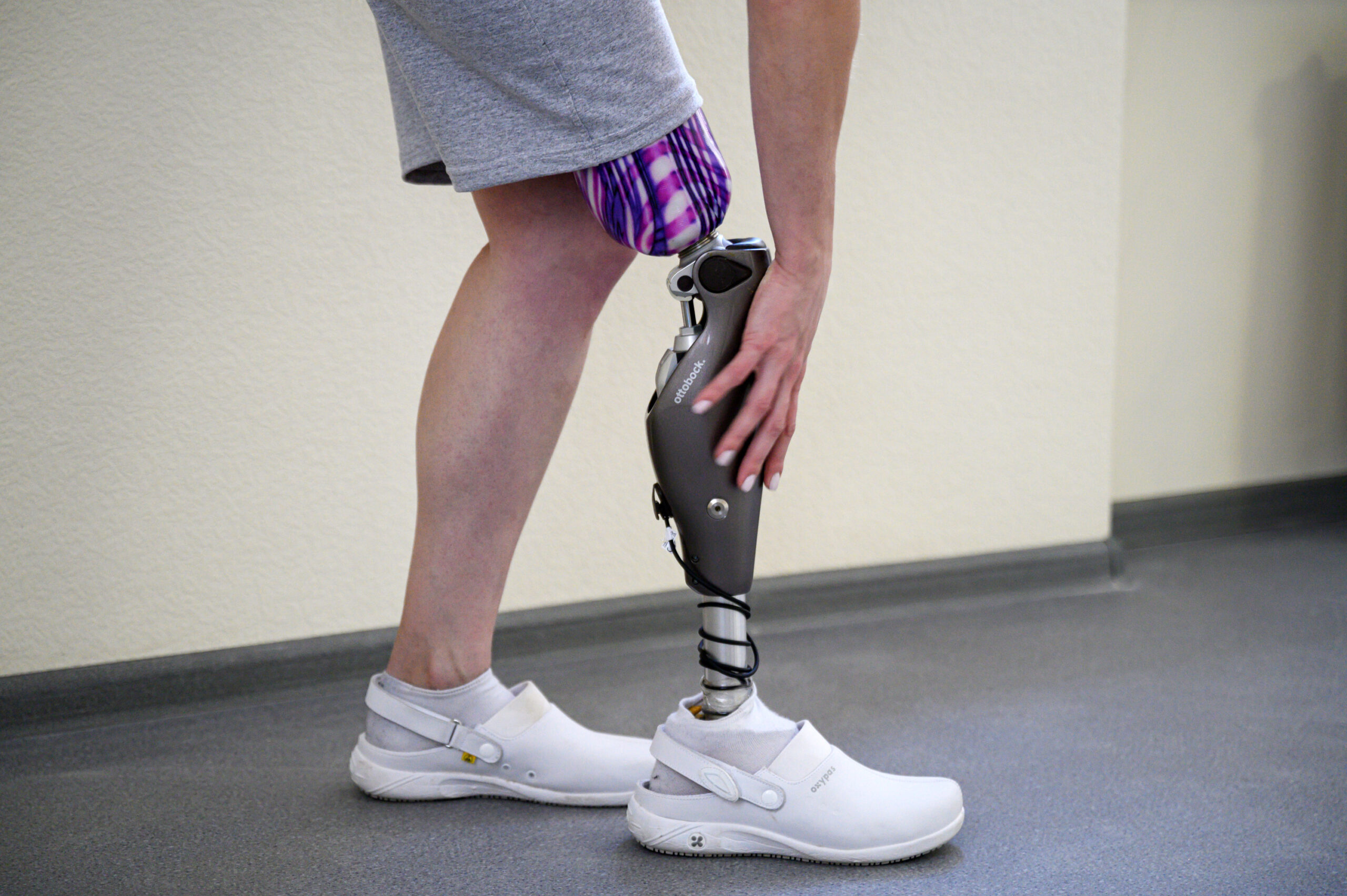 Протезирование ног: как устанавливать новые ноги и привыкать к ним