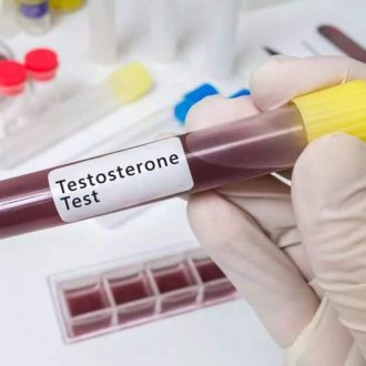 Анализ на уровень тестостерона в лаборатории IQlab