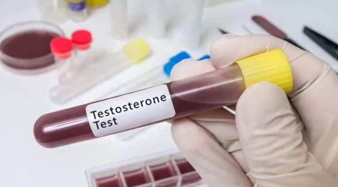 Анализ на уровень тестостерона в лаборатории IQlab