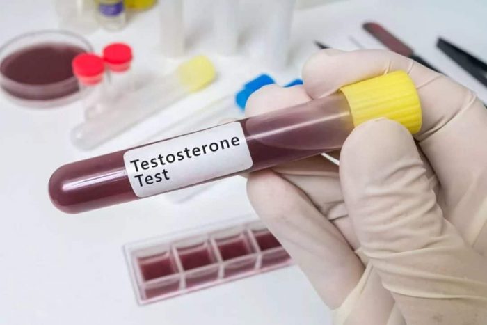 Анализ на уровень тестостерона в лаборатории IQlab