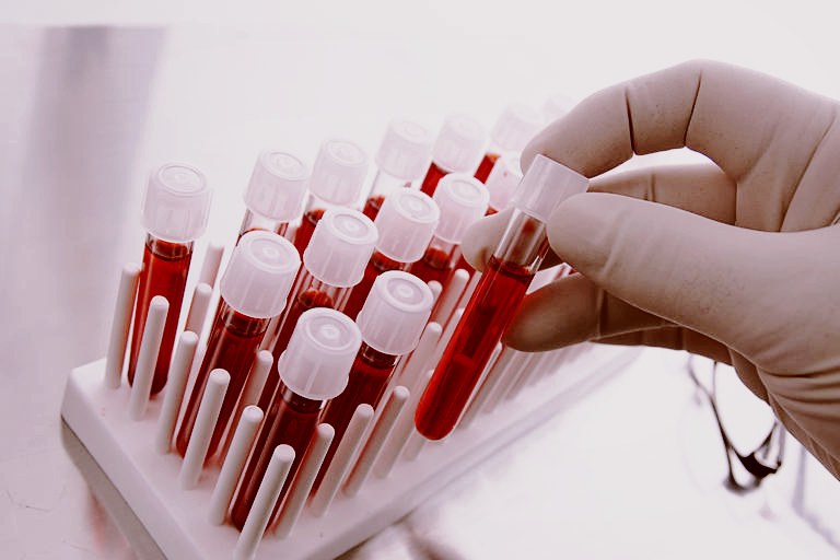 В чем причины повышения РФМК при беременности?