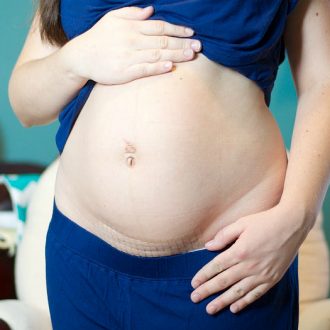 Когда можно заниматься сексом после кесарева сечения?