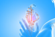 Кисти рук: как сохранить здоровье суставов, избежать артроза и боли в пальцах