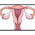 Маточный фактор бесплодия: причины и лечение