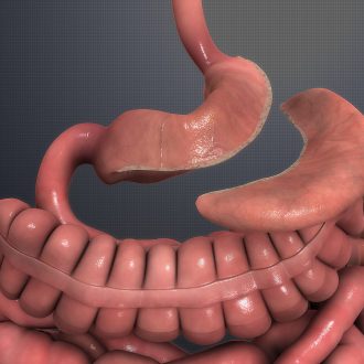 Отзыв лечения ожирения при помощи бариатрии