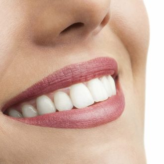 Костная пластика при имплантации зубов: что это и какая бывает