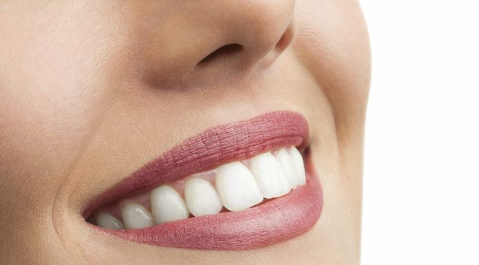 Костная пластика при имплантации зубов: что это и какая бывает