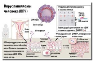 Прививка от рака шейки матки (с какого возраста, вызывает ли бесплодие)