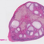 Фолликул: место в менструальном цикле и роль в зачатии Развивающиеся фолликулы