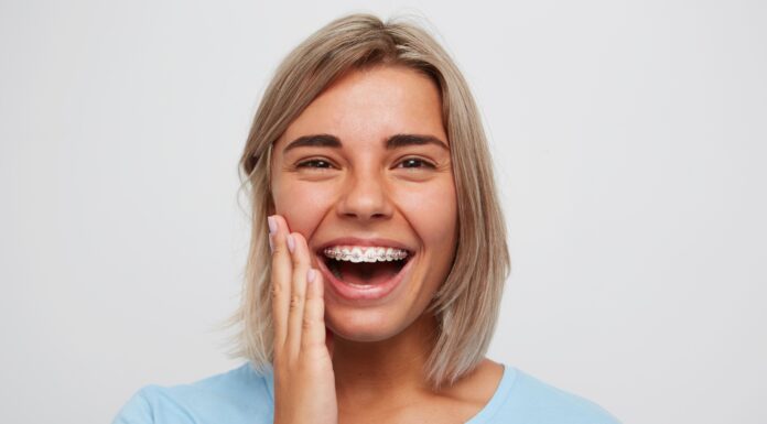 Установка брекетов в профильной стоматологической клинике