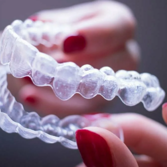 Описание элайнеров и их особенности