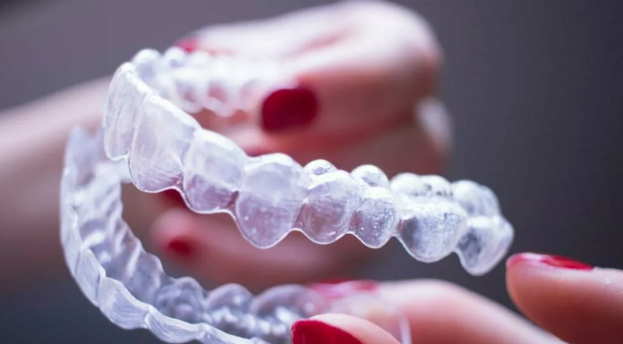 Описание элайнеров и их особенности