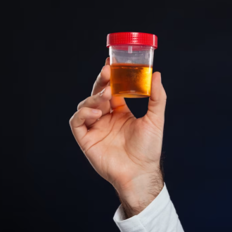 Анализ мочи: что следует знать про данный анализ, кто его назначает, какие проблемы выявляет