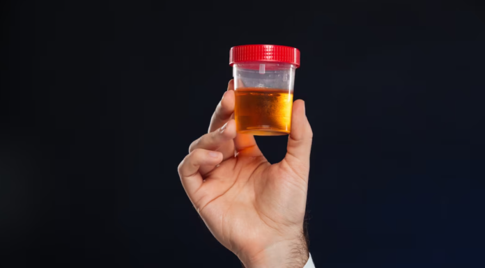 Анализ мочи: что следует знать про данный анализ, кто его назначает, какие проблемы выявляет