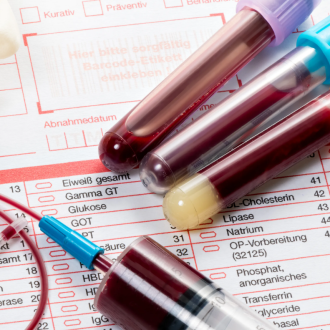 Почему важно регулярно сдавать анализы и проходить ЭКГ?