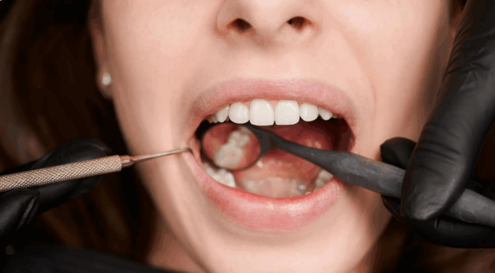 Пересадка зуба: инновационный метод восстановления утраченных зубов