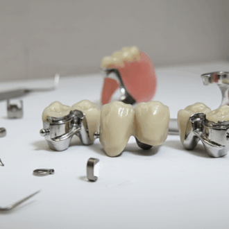 Аттачменты в стоматологии: инженерный подход к фиксации протезов