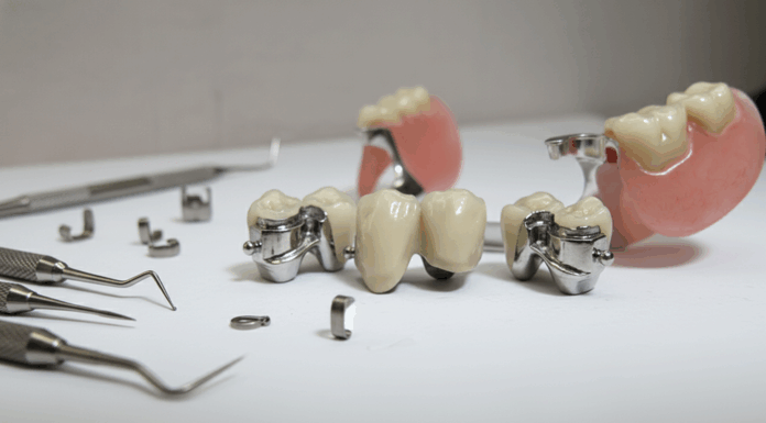 Аттачменты в стоматологии: инженерный подход к фиксации протезов