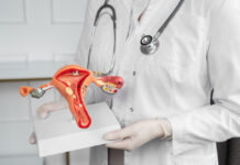 Удаление маточных труб лапароскопия: безопасный и современный метод