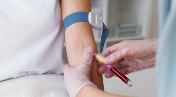 Анализ крови на ТТГ: что нужно знать