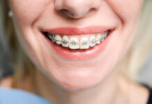 От неровных зубов к сияющей улыбке: история вашего преображения