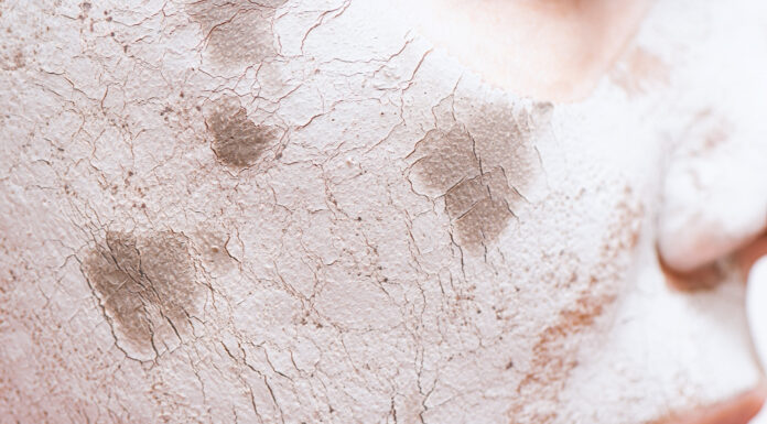 Уход за сухой кожей лица