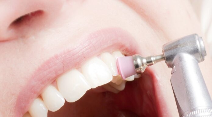 Гигиеническая чистка зубов. Зачем она нужна?