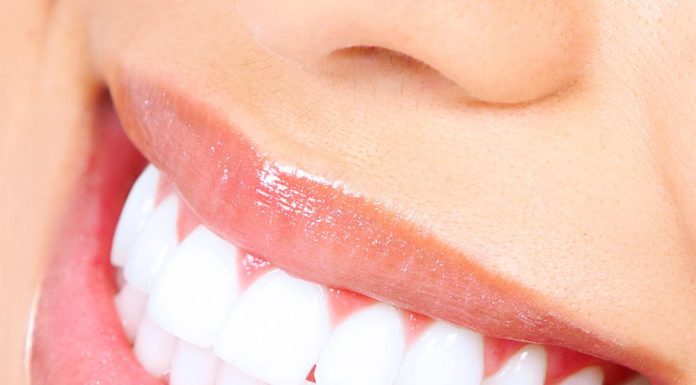 Что вам нужно знать об имплантах?