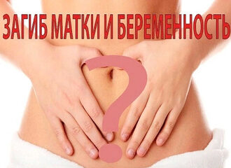 Как забеременеть при загибе матки кпереди, кзади, влево, вправо