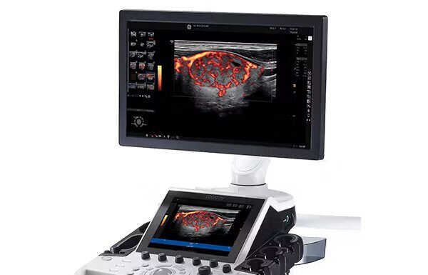 Аппарат УЗИ: как современные технологии меняют выяснение заболеваний