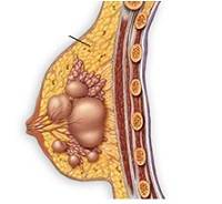 Индол форте при бесплодии