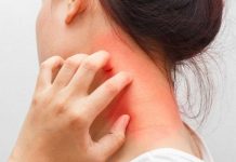 Советы по поддержанию здоровья при атопическом дерматите