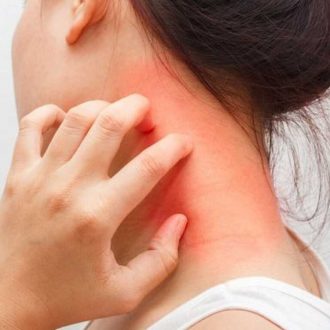 Советы по поддержанию здоровья при атопическом дерматите