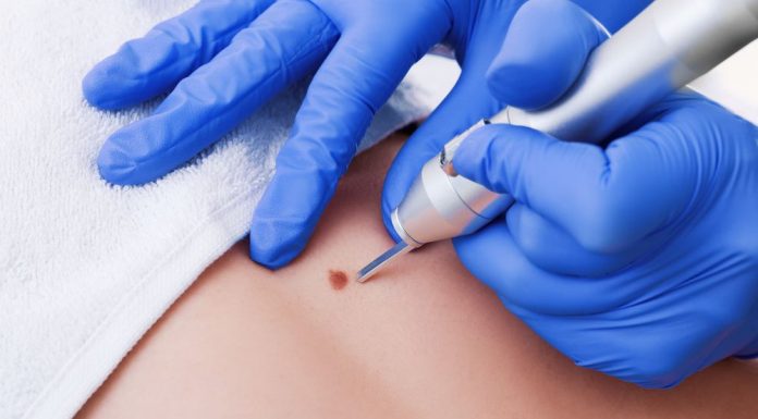 Как происходит удаление новообразований?