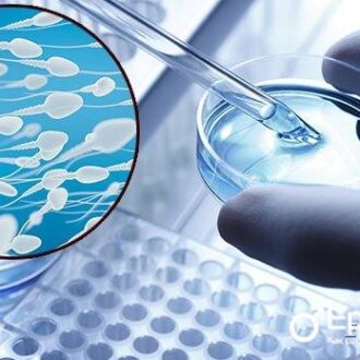 Какая должна быть сперма — объем, цвет, консистенция, кислотность и другие показатели